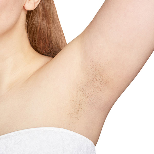 Unwanted Hair